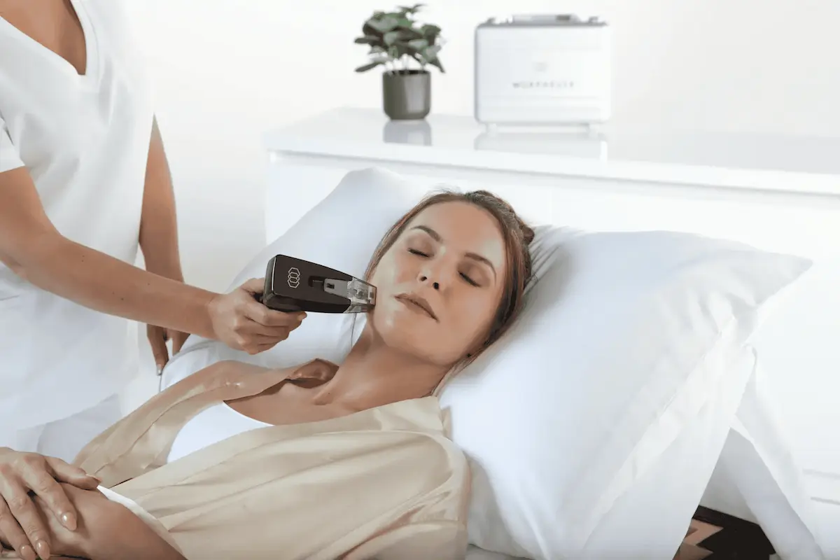 Performing Morpheus8 RF microneedling treatment on woman's face because Every Body is Unique at LHR Skin and Vein Center Rochester, MI