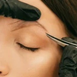 Preparing for your first electrolysis treatment
